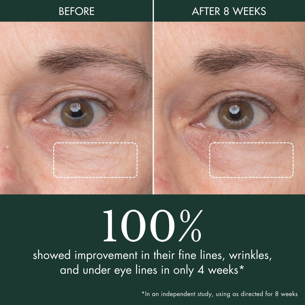 Peau Magnifique Eye Concentrate